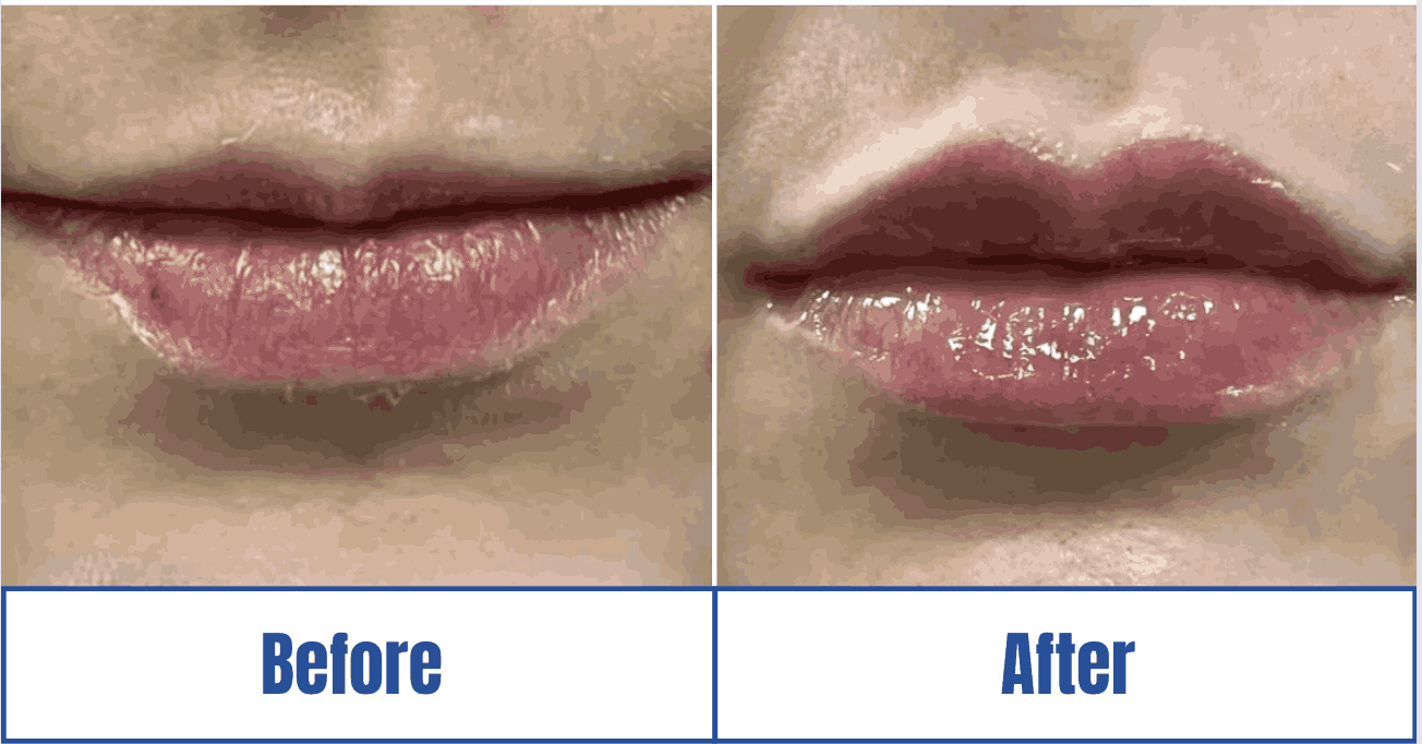 plastic surgery outcome display Plastic Surgery Outcome Display in the Dallas-Fort Worth Metropolitan Area