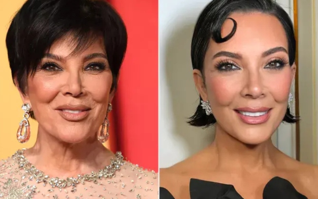 Deep Plane Facelifts: The Secret Behind Kris Jenner’s Youthful Look?