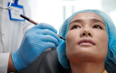 Facial Fat Grafting During a Facelift: Why it Creates More Natural Results